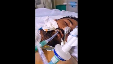 شاهکار جدید جراحان ایرانی / جراحی موفقیت‌آمیز پیوند سر قطع شده به بدن در ایران + فیلم –   تاجر ونیز